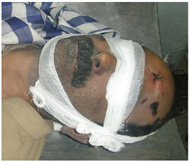 Shaheed Advocate Ali Sher Kurd- tortured body 3